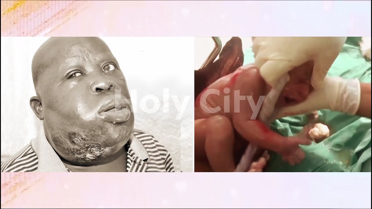 Unbelievable Miracle: Hodgkin lymphoma Disappeared and Baby Born Live in Church, All By God's Grace Manifested Through Bro. Ronnie